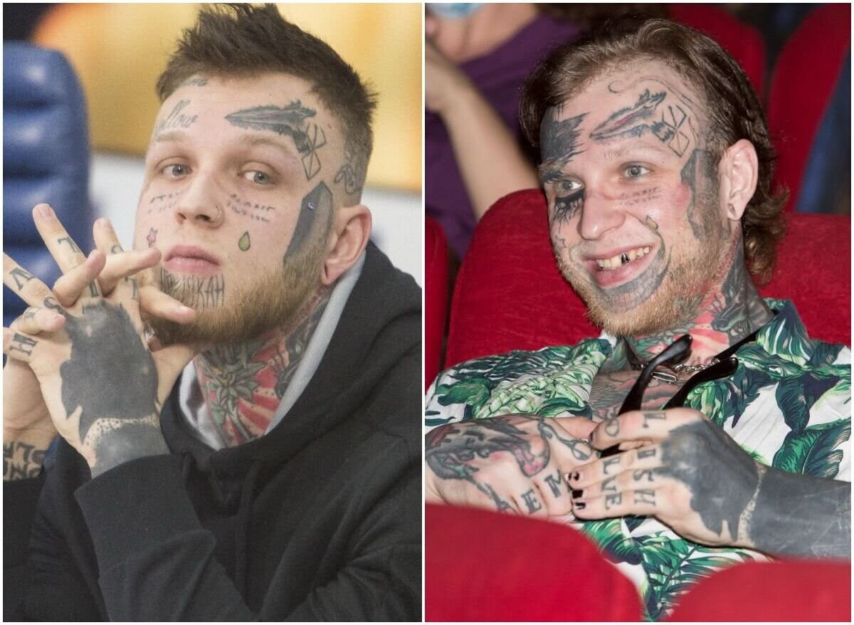 сын яковлевой удалил татуировки с лица